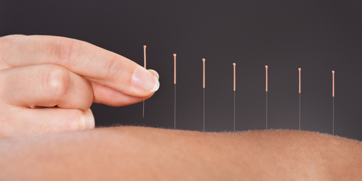 Acupuncture for Addiction Treatment
